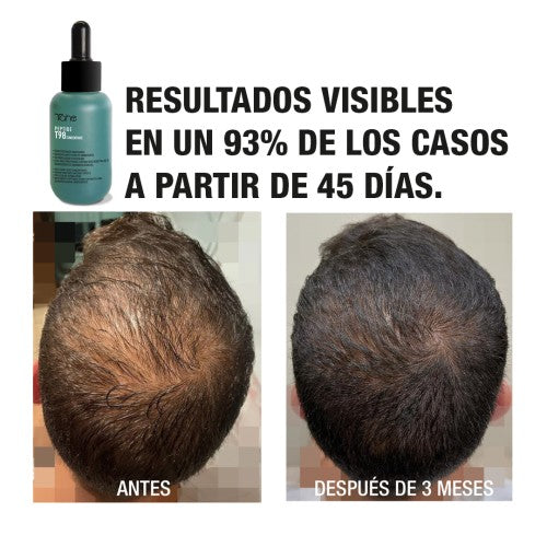 TAHE T98 Concentrado 6x10 ml + Champú Peptide