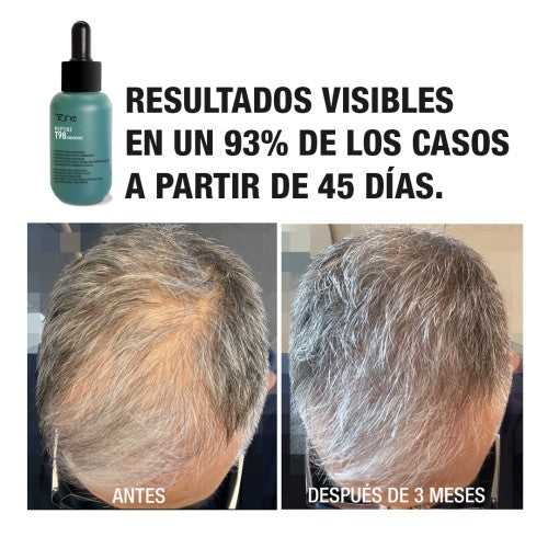 TAHE T98 Concentrado 6x10 ml + Champú Peptide